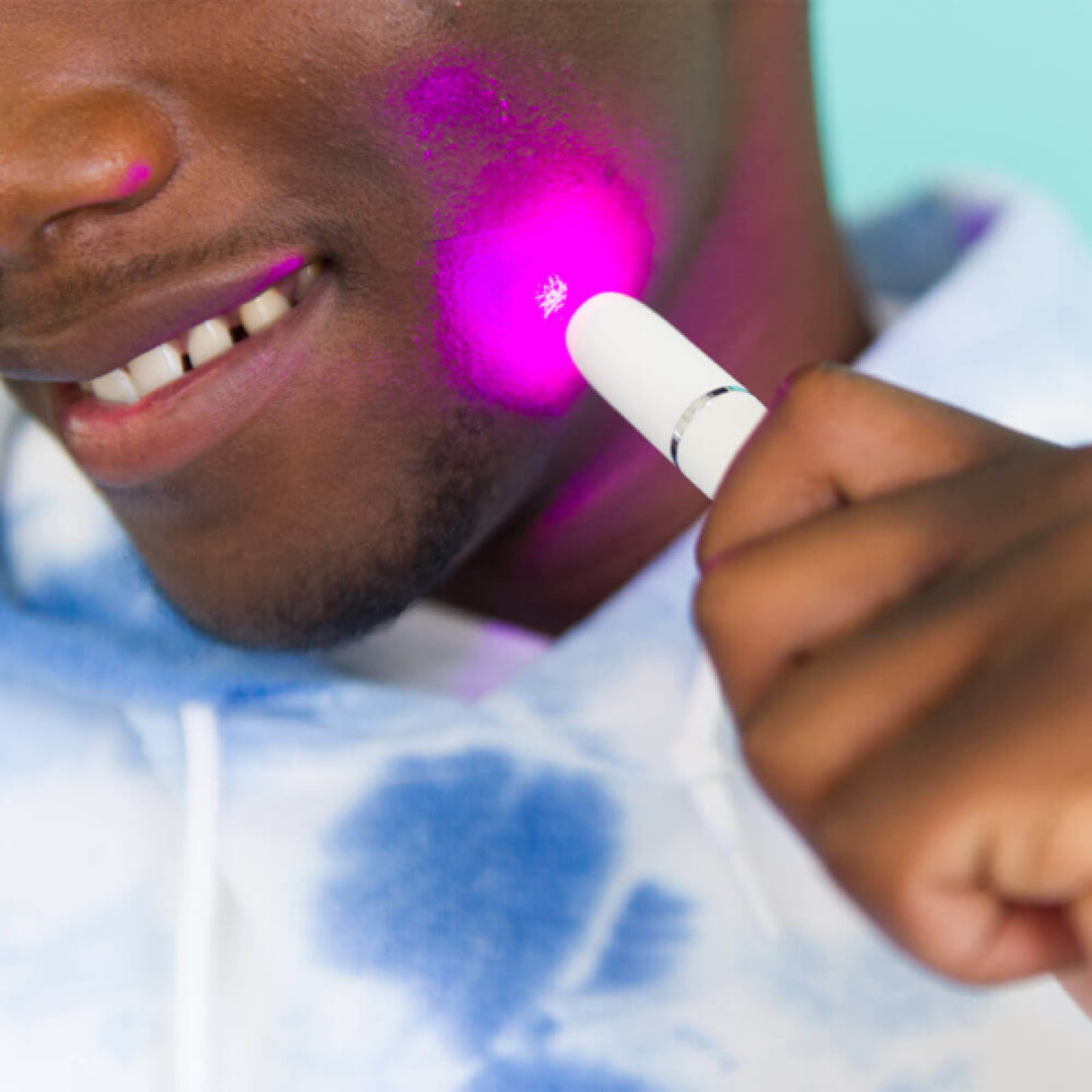 Poof — Portable LED Light Acne Treatment