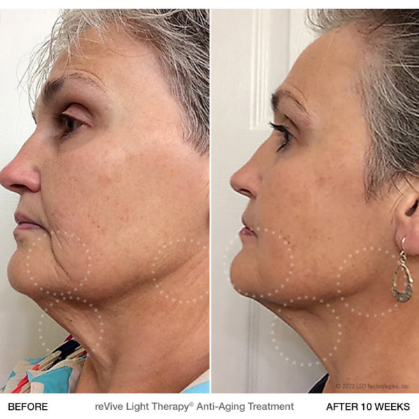 Open Box Glō Anti-Aging