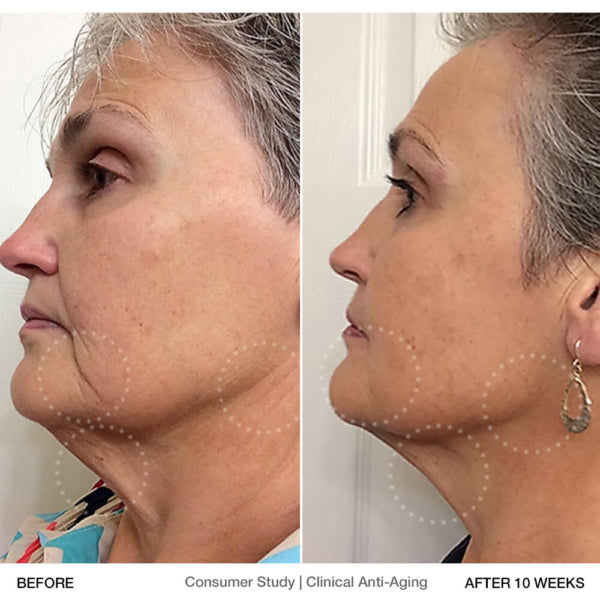 Open Box Clinical Anti-Aging